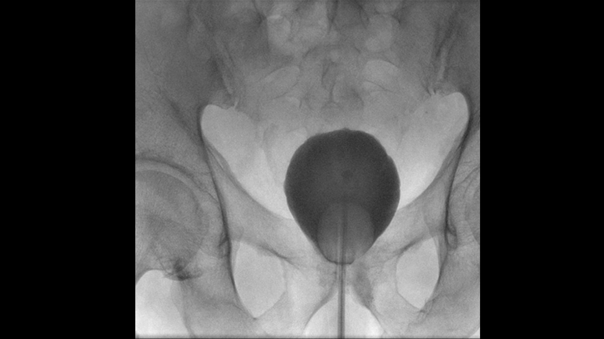 Urology device Uroskop Omnia Max - Siemens Healthineers USA