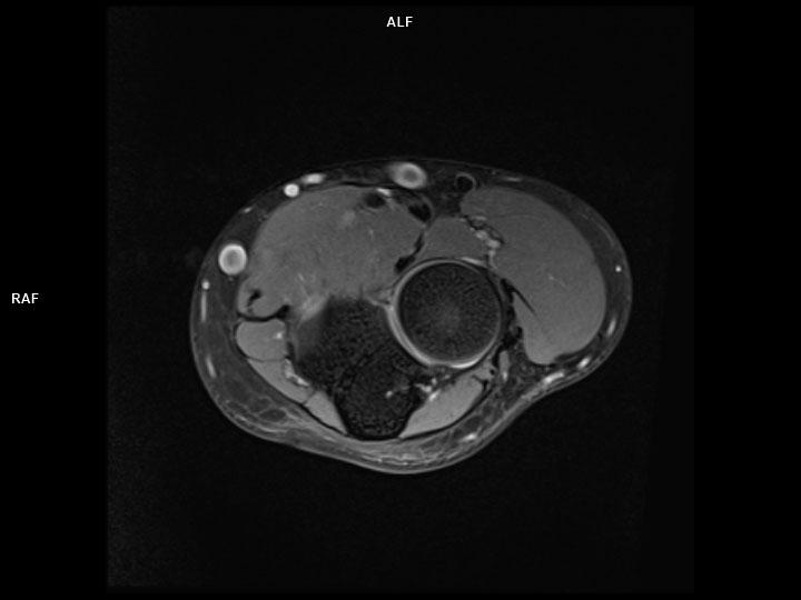 Axial PD FS-MAGNETOM Lumina