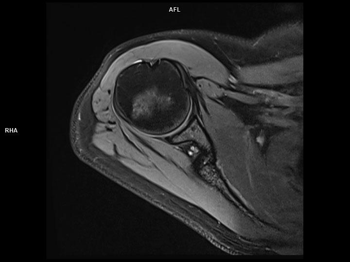 Axial PD FS-MAGNETOM Lumina