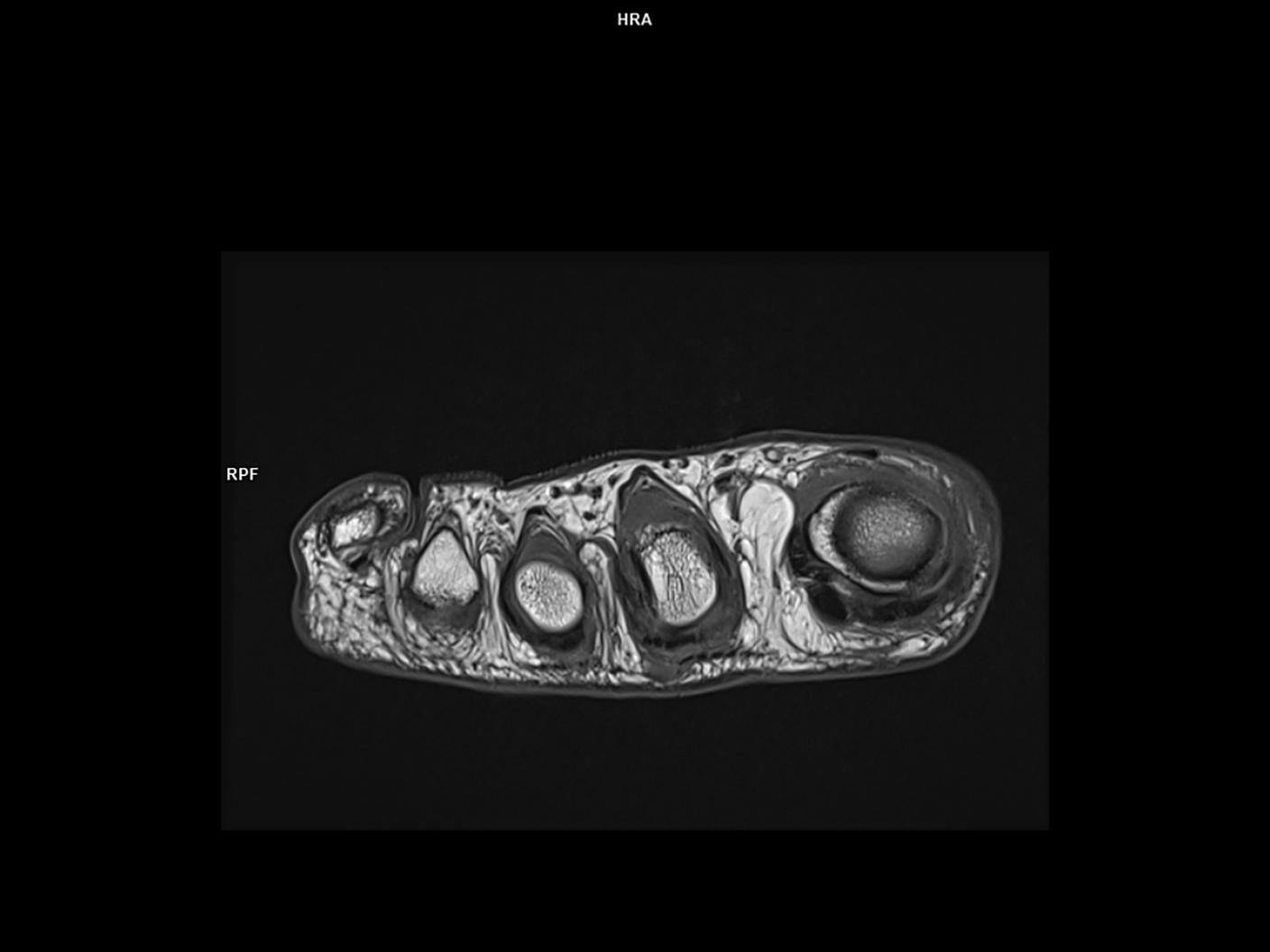 Axial T1 TSE-MAGNETOM Vida