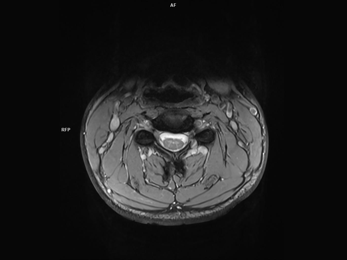 Coil-HeadNeck 64/Resolution-384/Aceleration-p2
