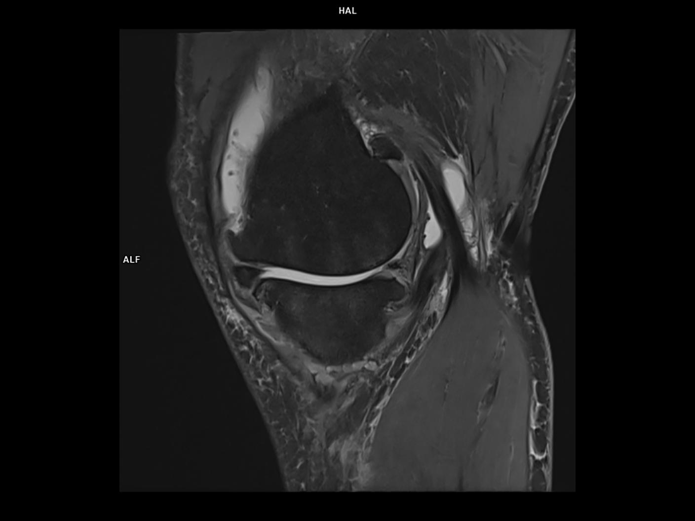 Saittal PD FS-MAGNETOM Vida