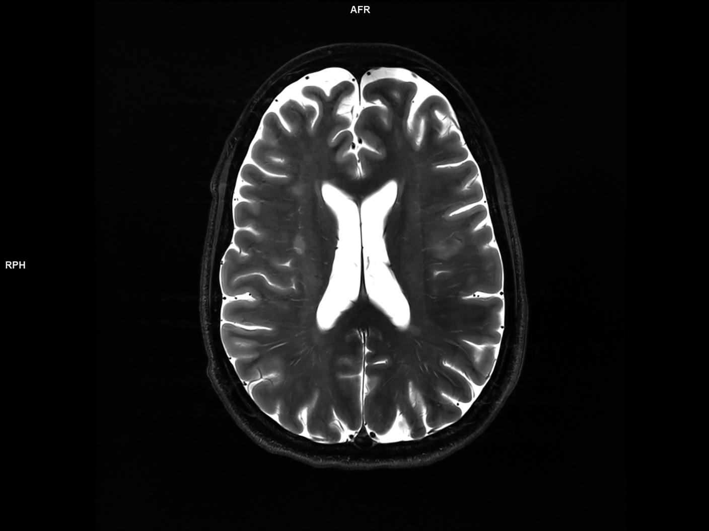 Axial TSE T2-MAGNETOM Terra