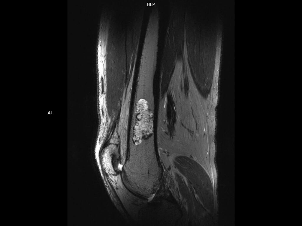 Sagittal T2 TSE 300um-MAGNETOM Terra