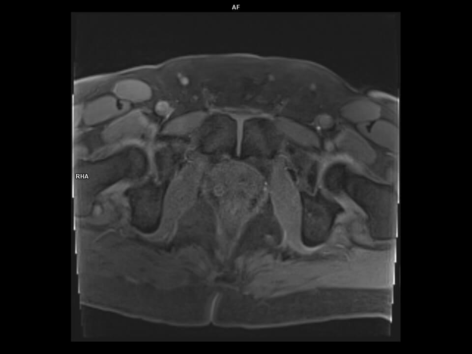AXIAL GRASPVIBE DYNAMIC-MAGNETOM Vida