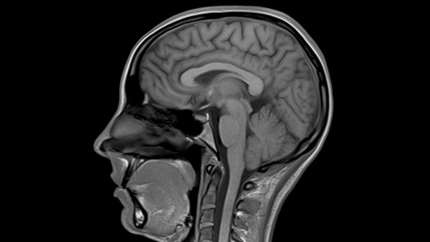 clinical image neurology