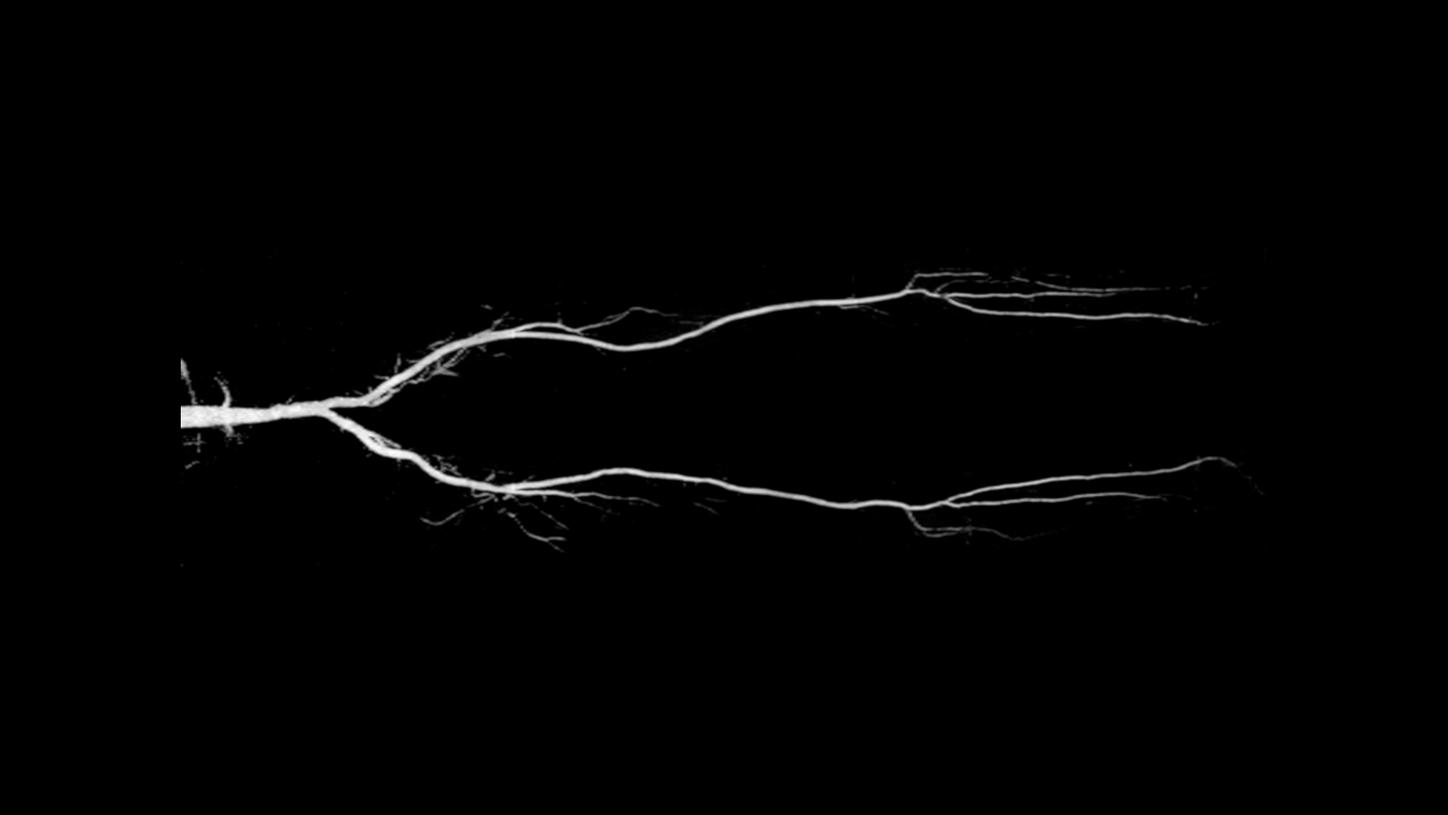 Siemens - MRI - MAGNETOM Skyra - Image - Angiography