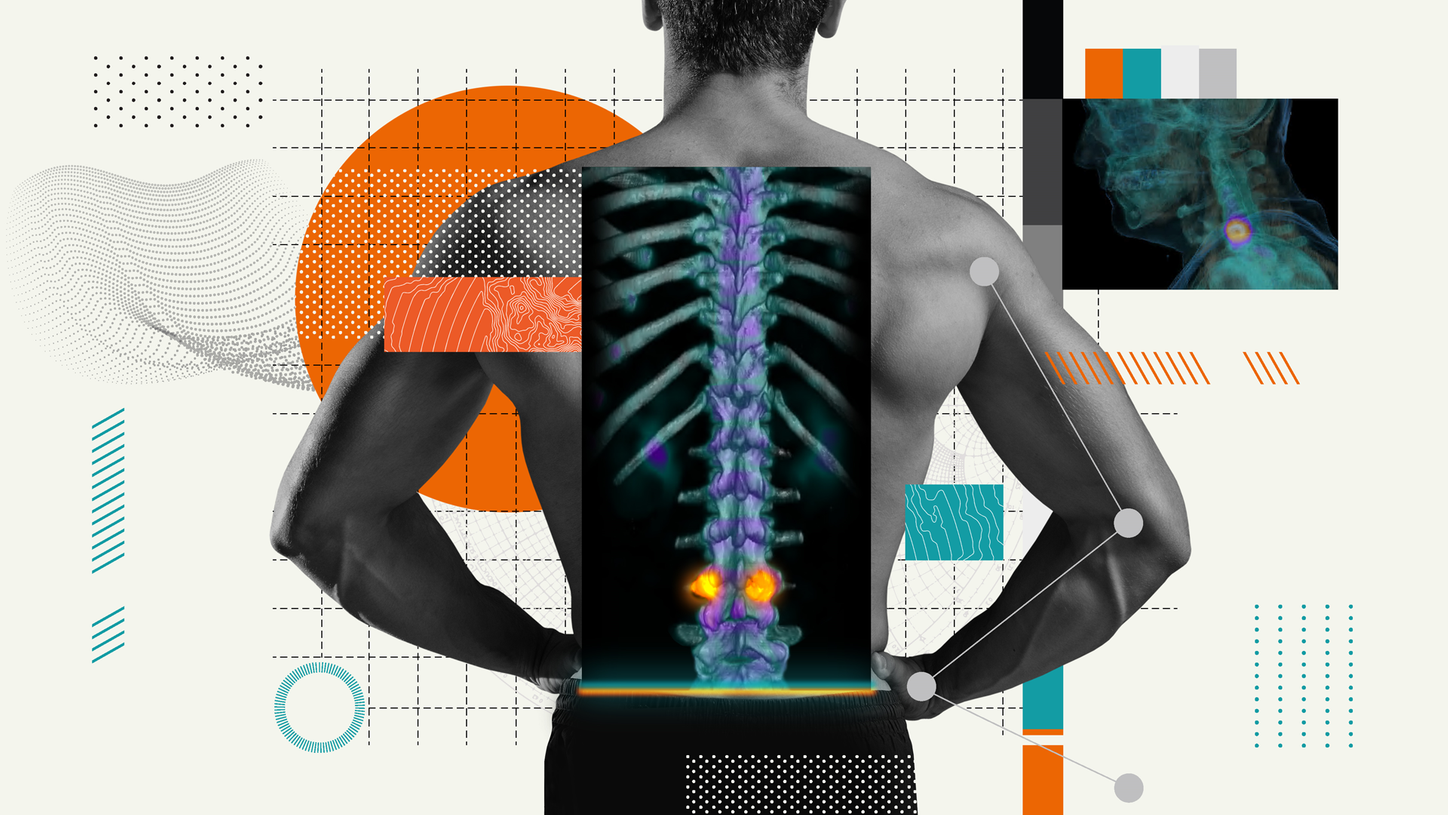 An illustration depicts the convergence of nuclear medicine and musculoskeletal medicine.