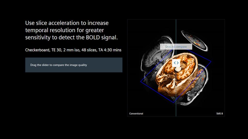 MR Neuro Imaging MRI Neurology Siemens Healthineers