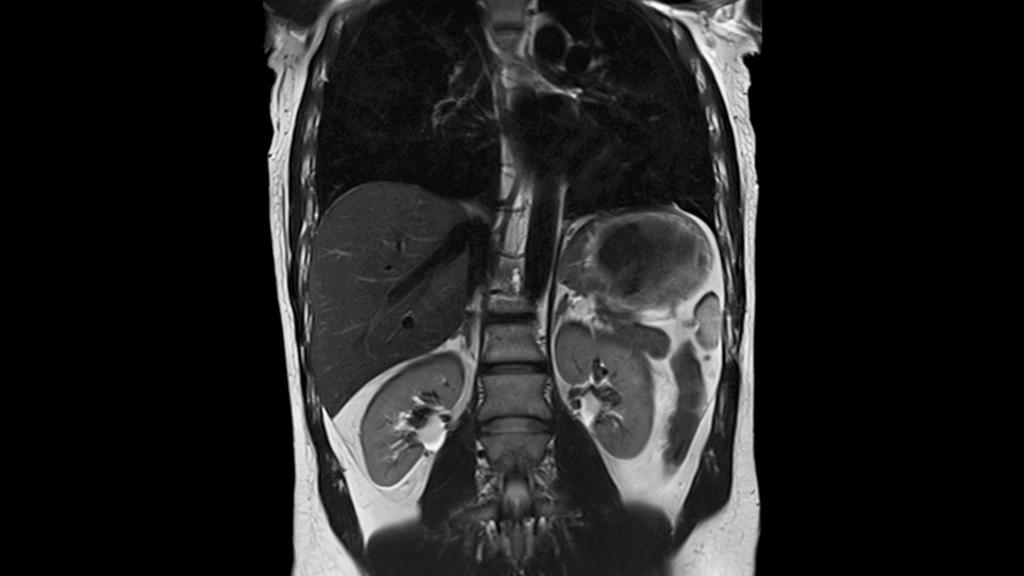 Body MRI