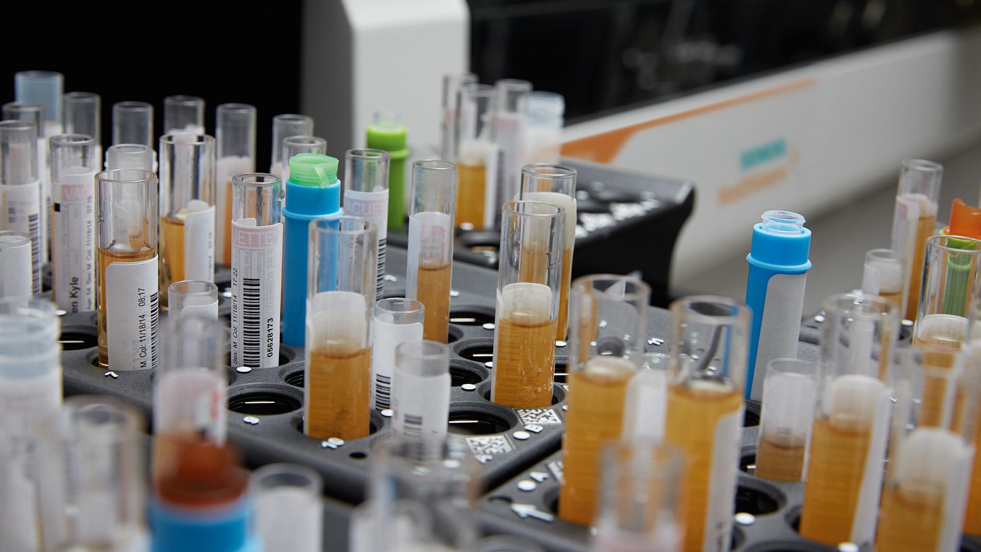 Patient Lab Testing The Role of Laboratory Test Biomarkers in Diagnosis, Risk ...