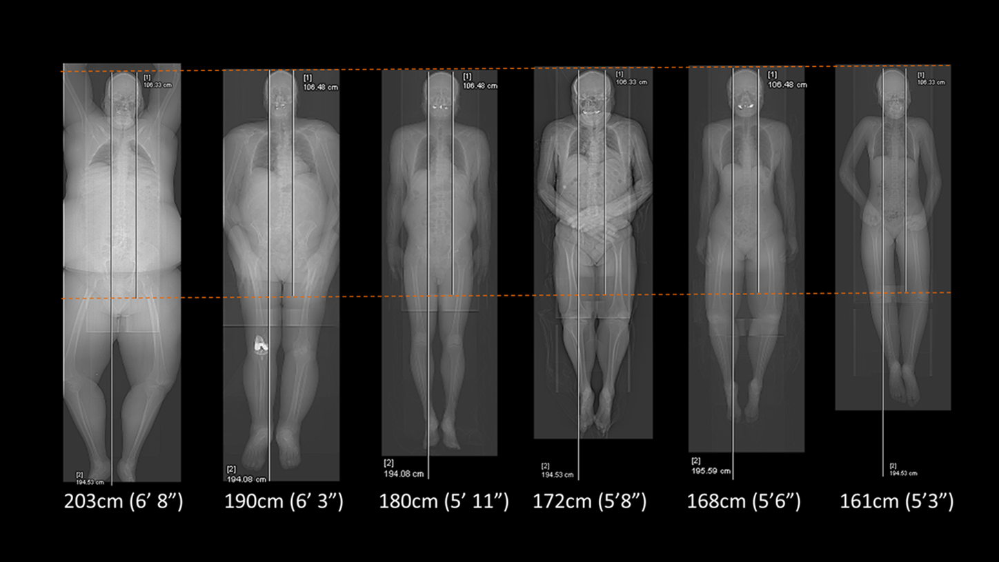 Siemens Healthineers MI Quadra scans