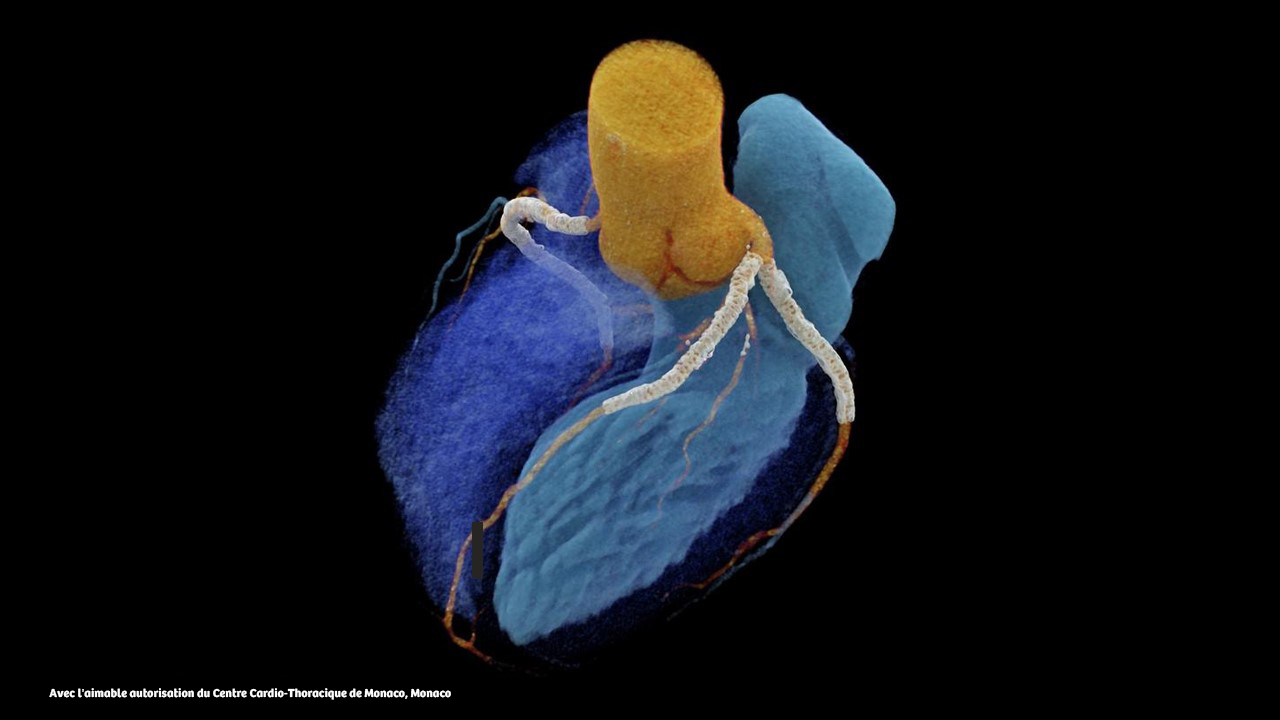 Naeotom-Alpha-Peak-FR_FR