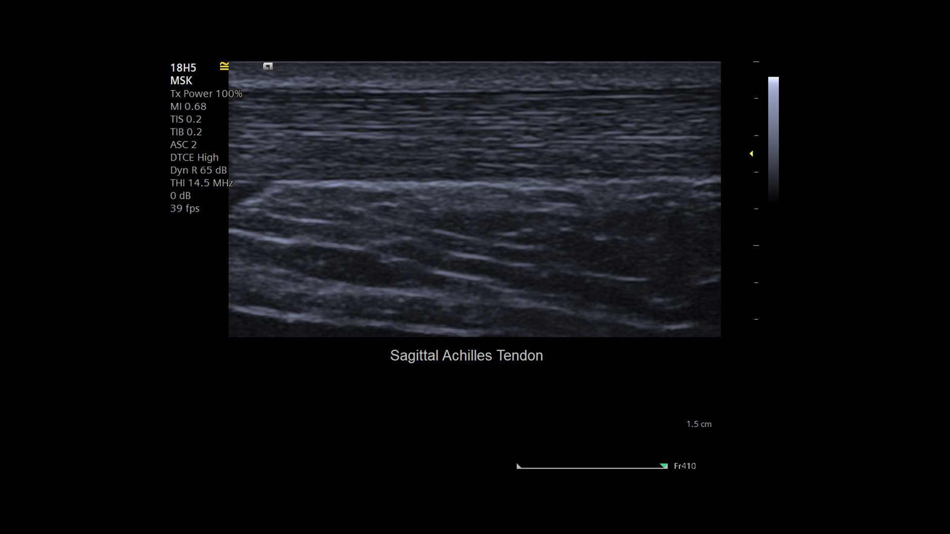 ACUSON Juniper Ultrasound System Siemens Healthineers USA