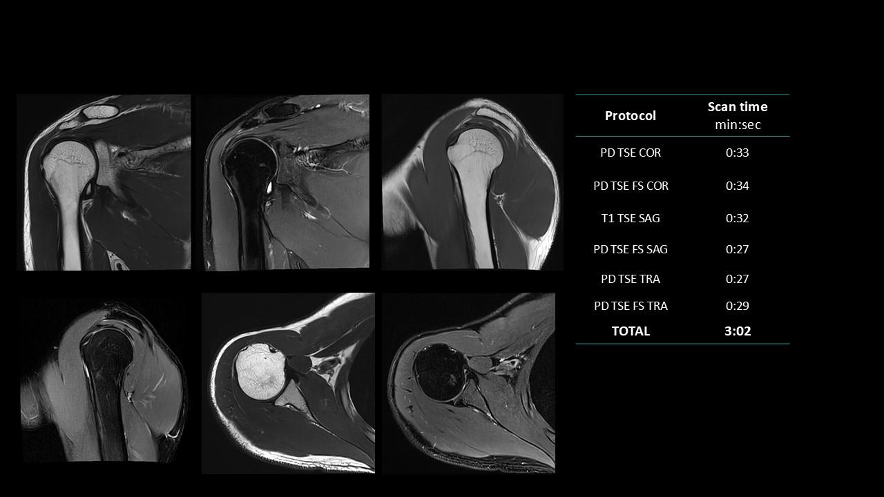 siemens-healthineers_magnetomworld_Shoulder-rountine