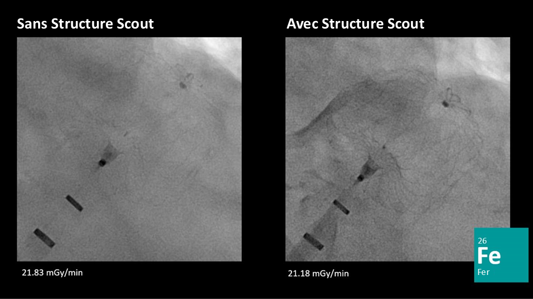 ARTIS icono Structure Scout FR