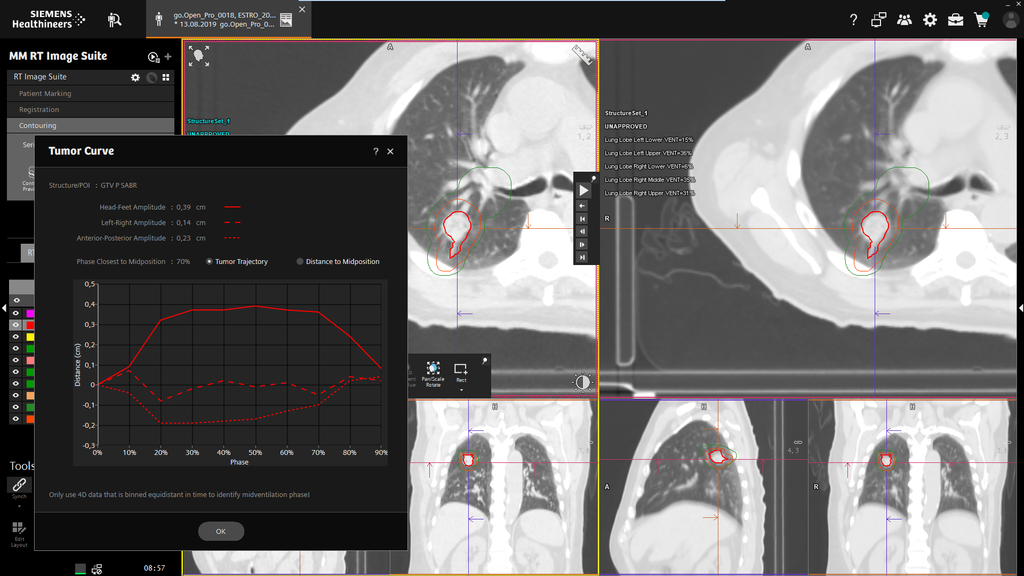 syngo.via RT Image Suite - Siemens Healthineers