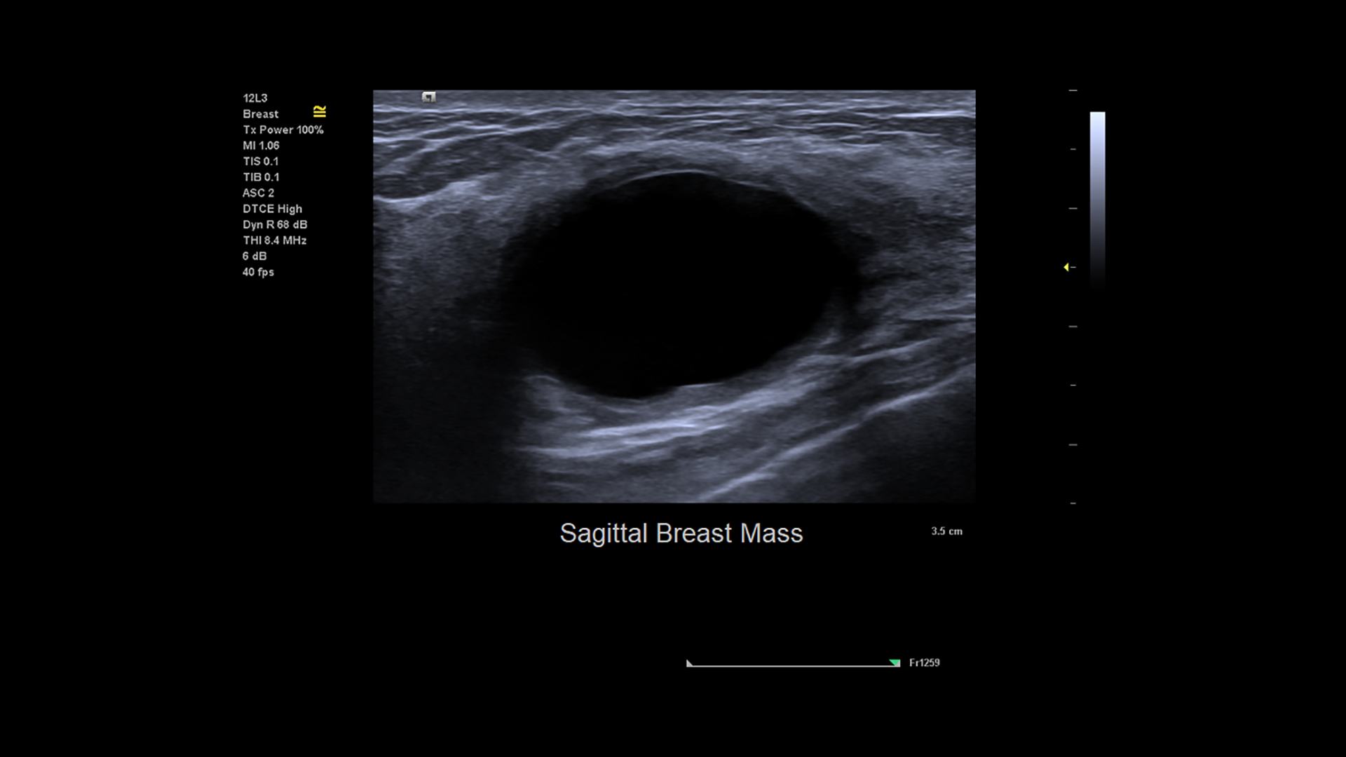 ACUSON Juniper Ultrasound System Siemens Healthineers USA