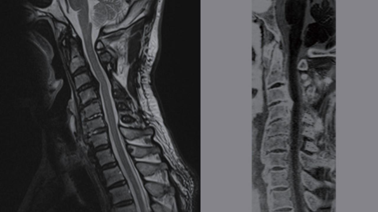 JP-MR-BoneImaging