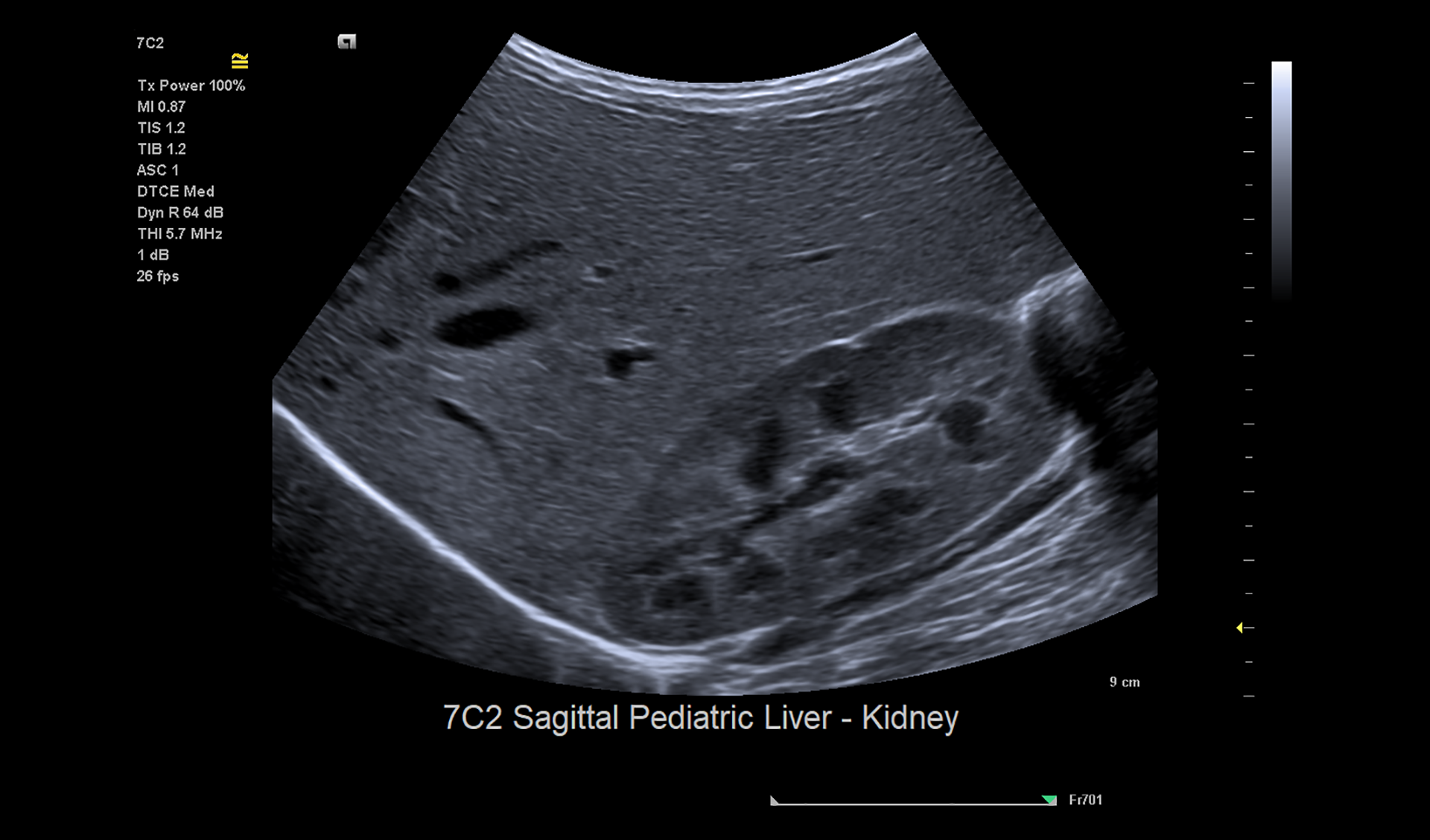 ACUSON Juniper Ultrasound System Siemens Healthineers Phillipines