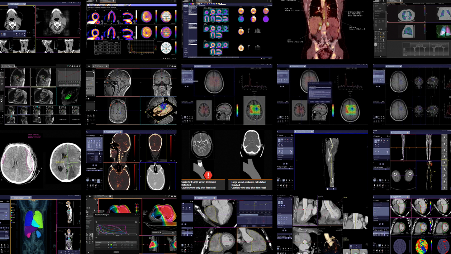 Discover our AV and AI solutions in radiology