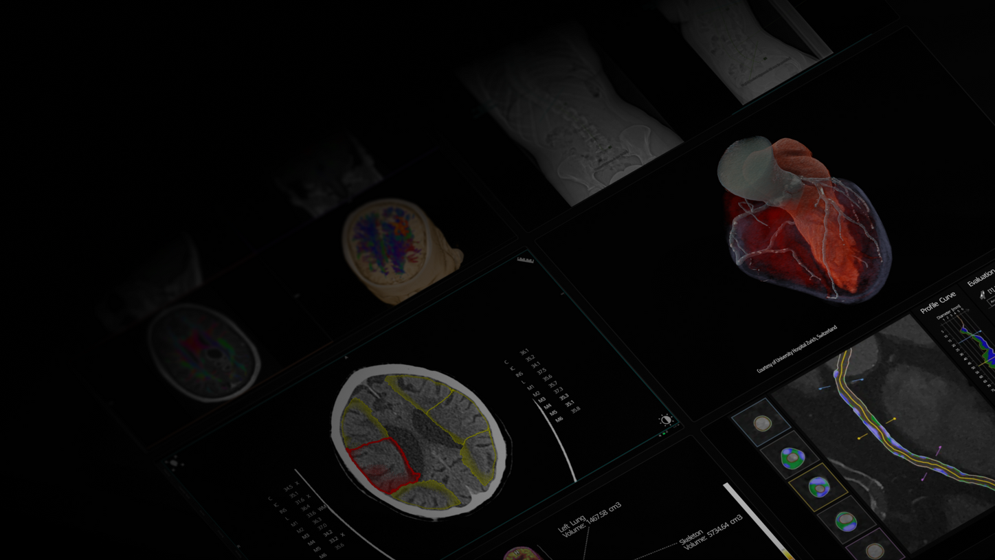 Discover our AV and AI solutions in radiology