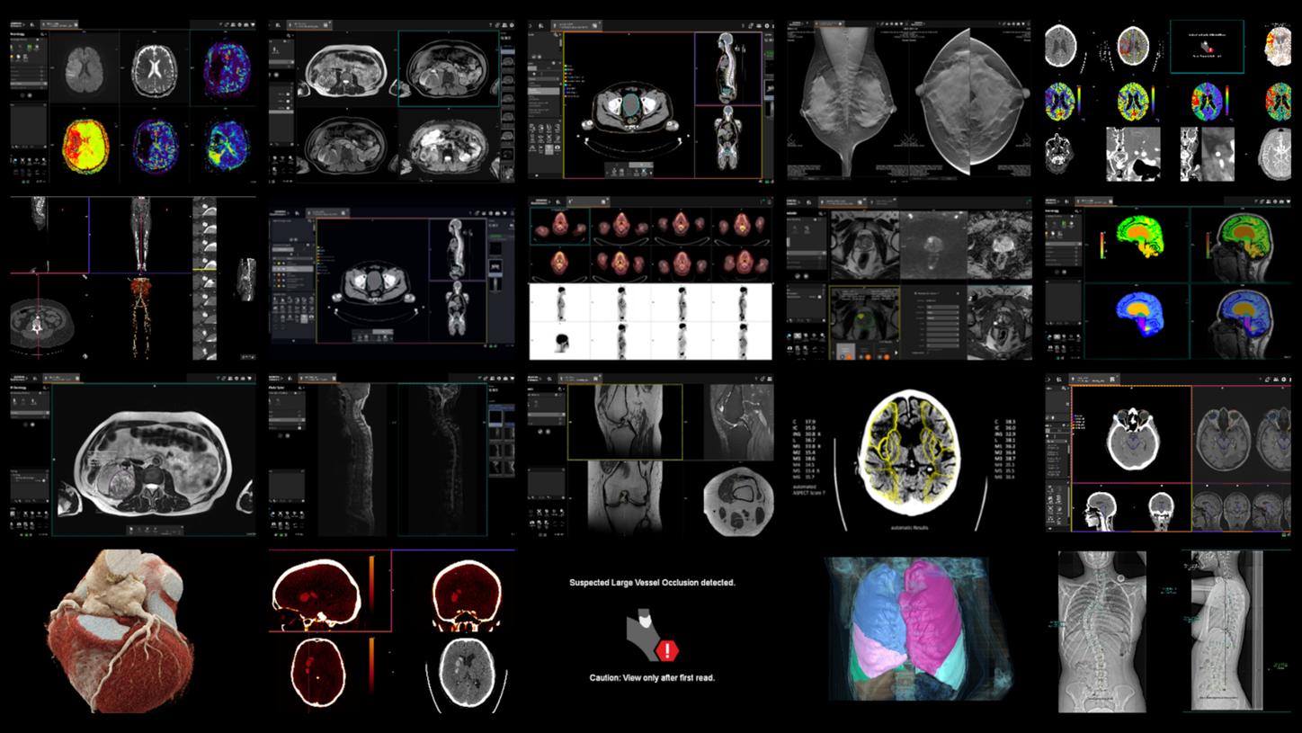 Discover our AV and AI solutions in radiology