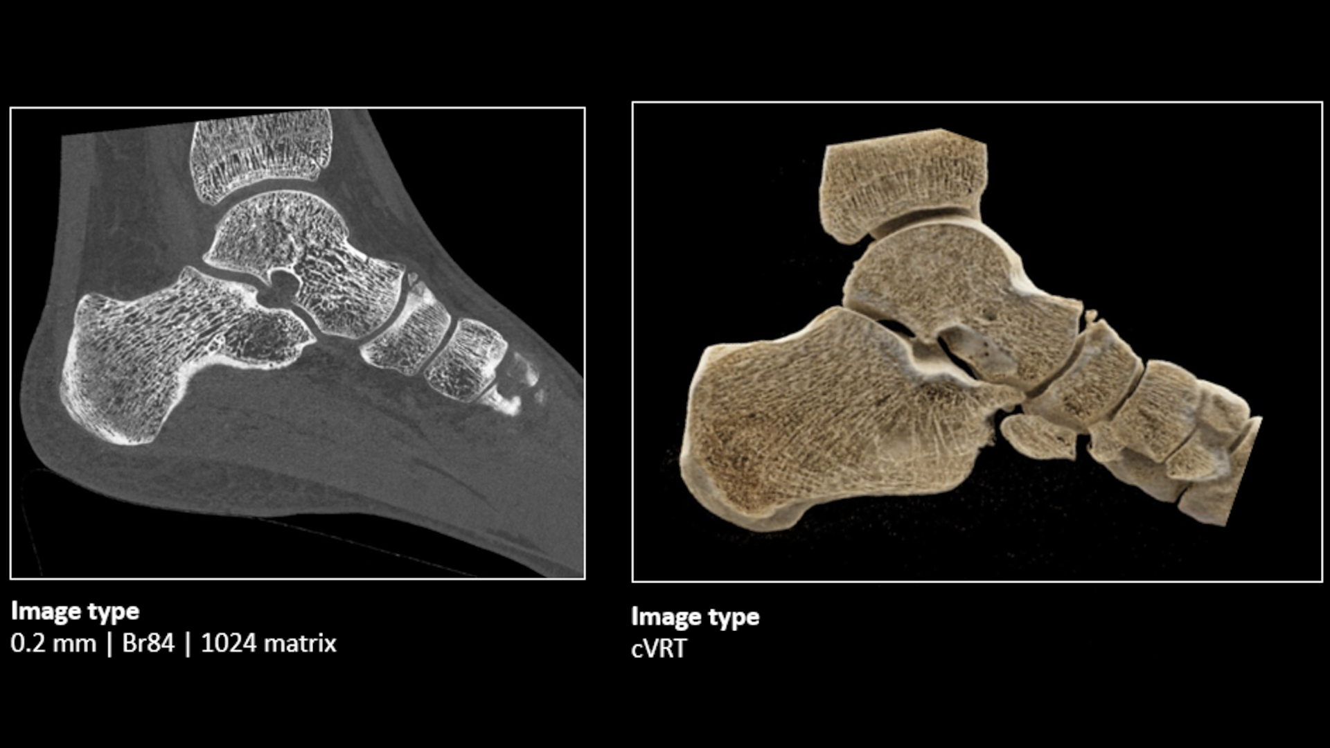 The Siemens Healthineers CT Imaging Chain - Siemens Healthineers Canada