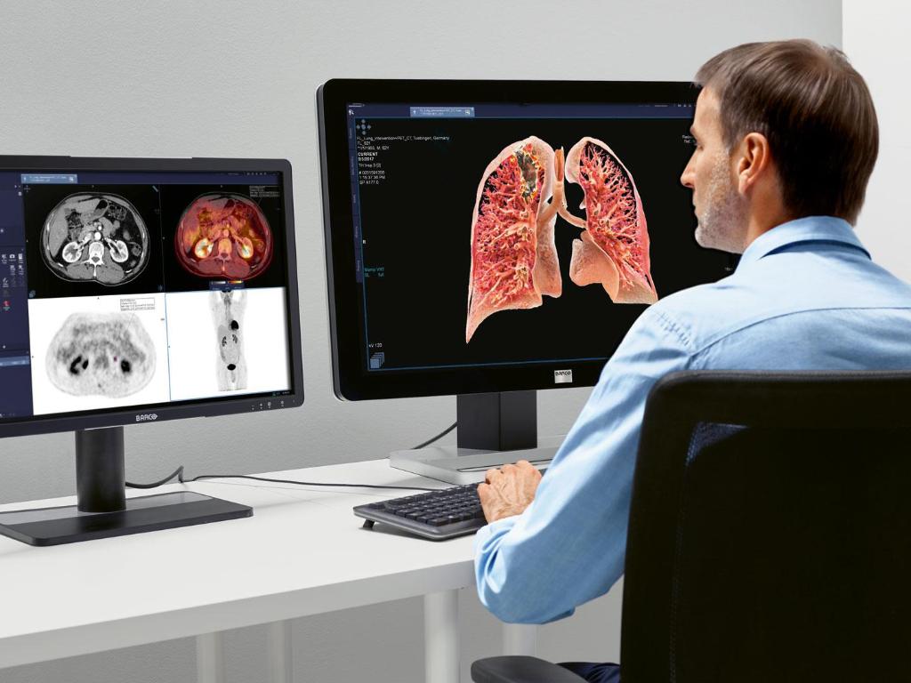syngo.via for Oncology