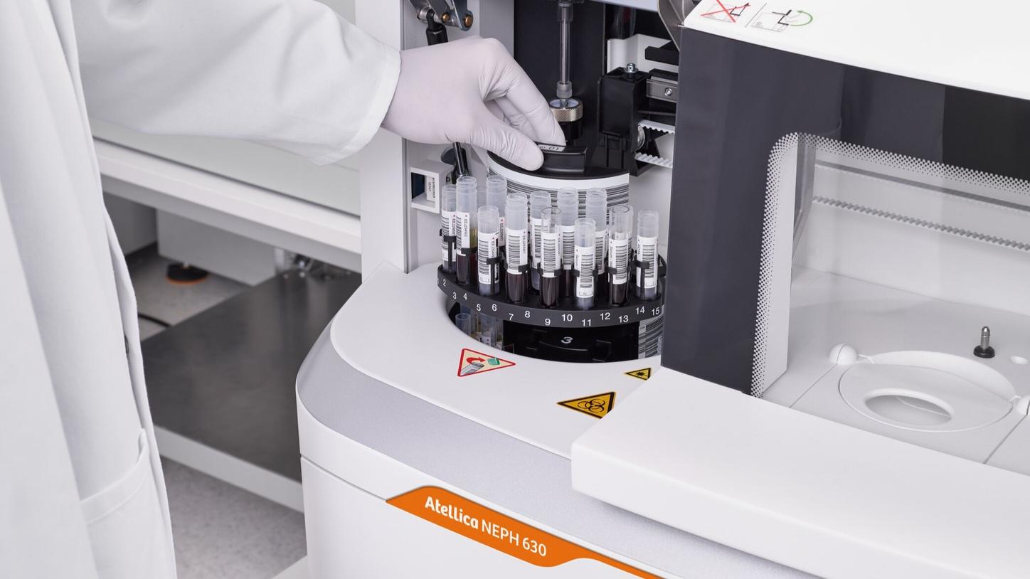 Laboratory professional loading blood sample tubes into the Atellica NEPH 630 analyzer for automated protein testing