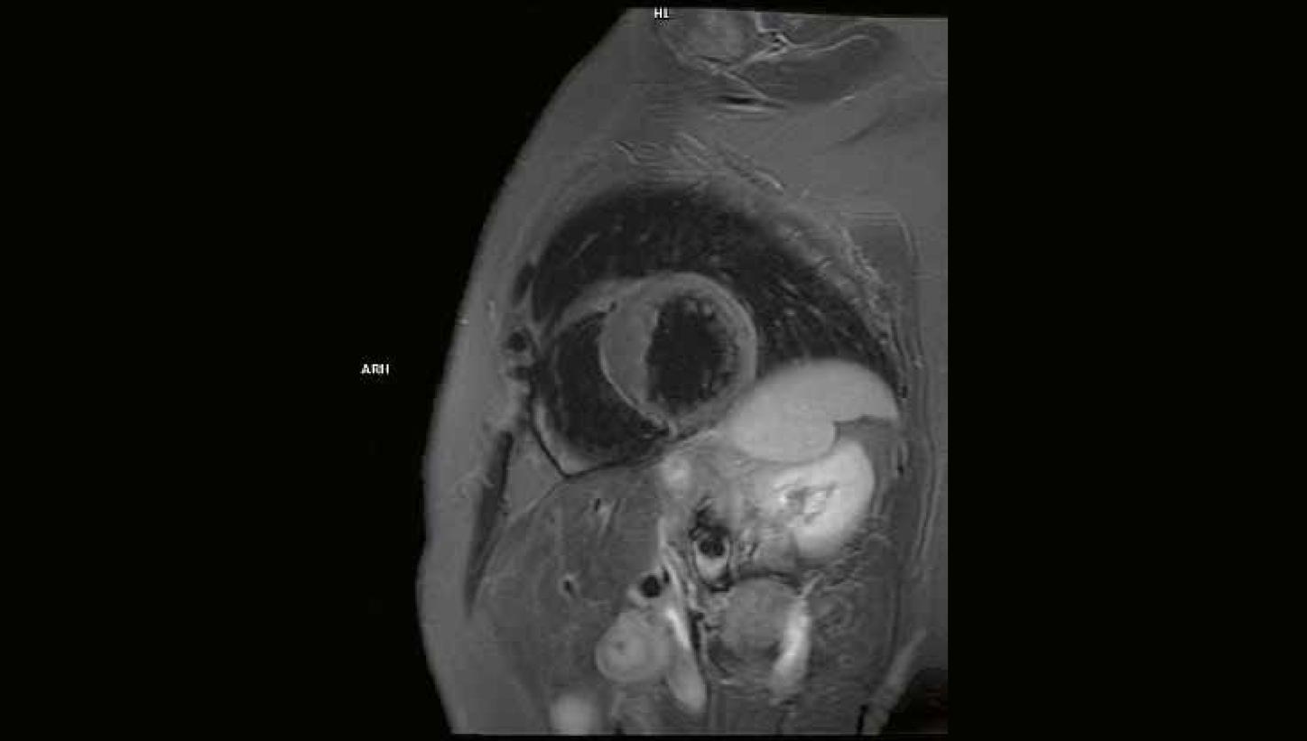Clinical case MRI Cardiology imaging 2026
