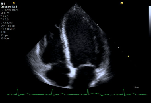 Echocardiography findings