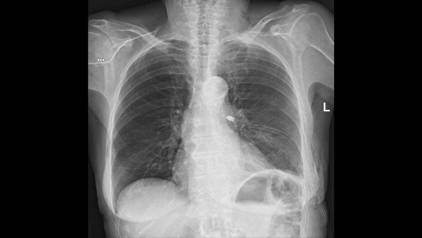 DI XP Luminos Qnamix Chest