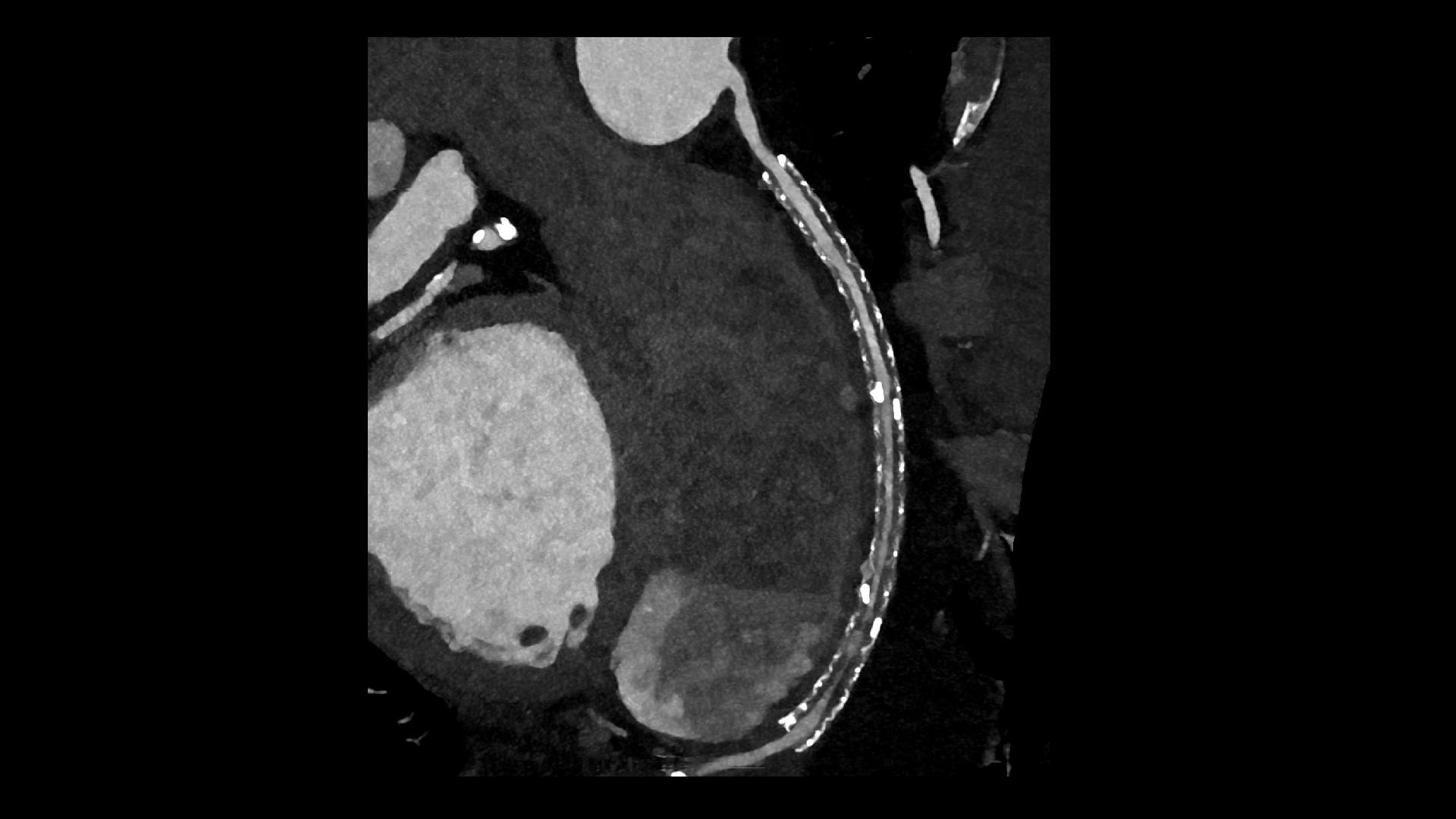 Computed Tomography - Siemens Healthineers