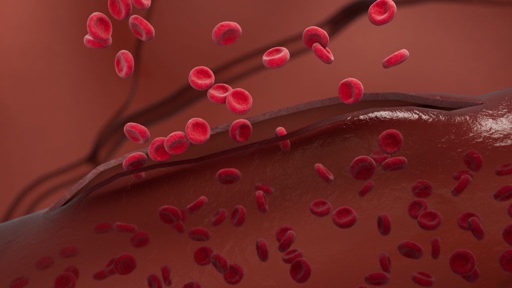 Hemostasis Learning Essentials - Siemens Healthineers