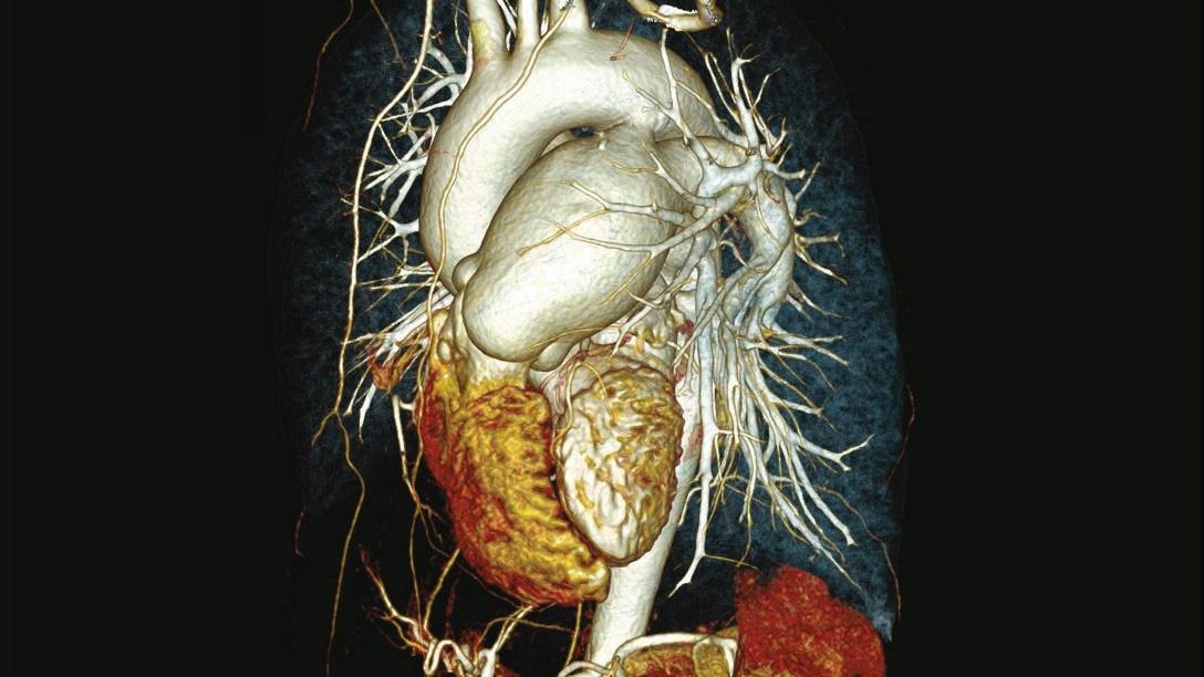 Kardiologiczny rezonans magnetyczny