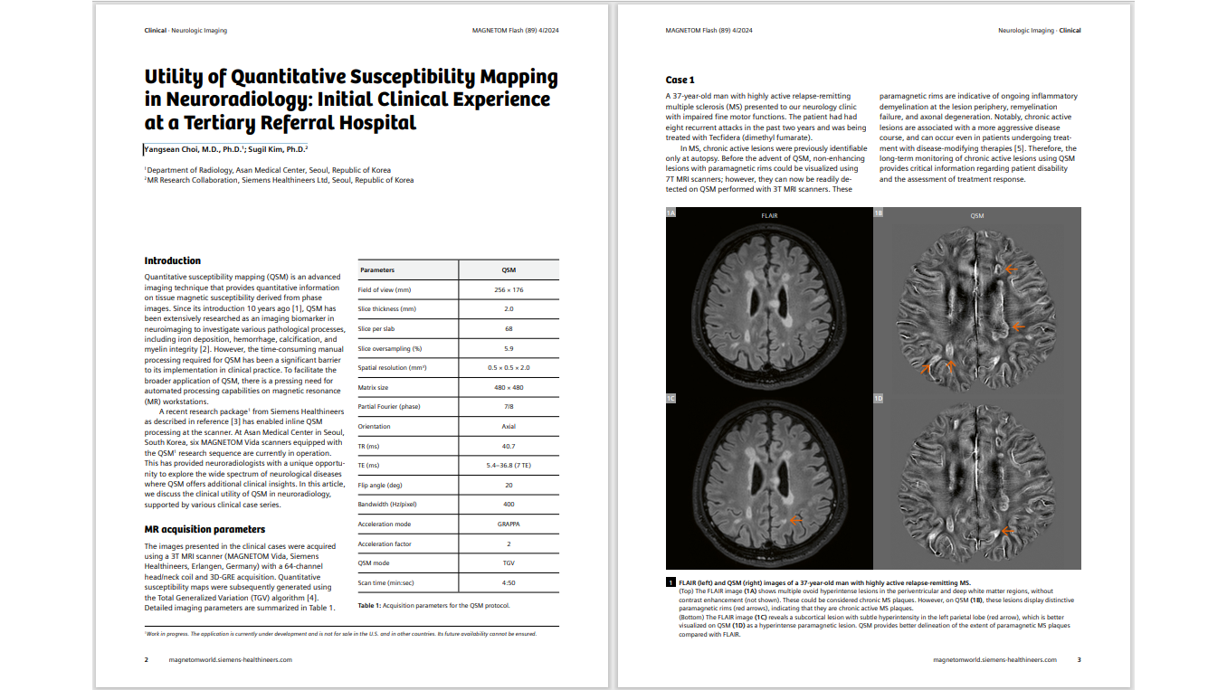 Siemens-healthineers_Magnetomworld_Susceptibility-Mapping
