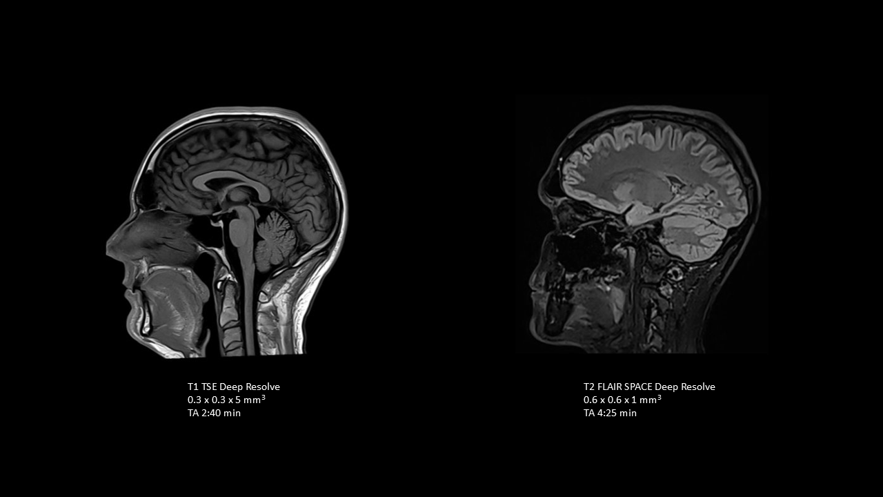 T1 and T2 FLAIR imaging for sagittal brain assessment  