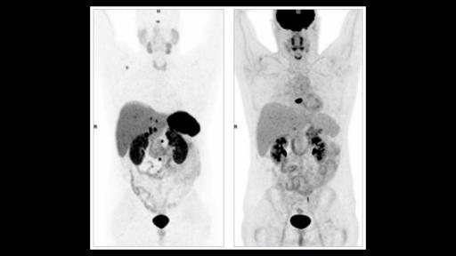 Exploring New Research Avenues - Siemens Healthineers