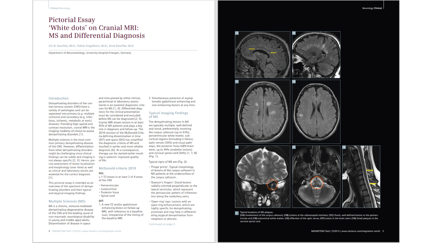 siemens-healthineers_Magnetomworld_White-dots-Cranial-MRI