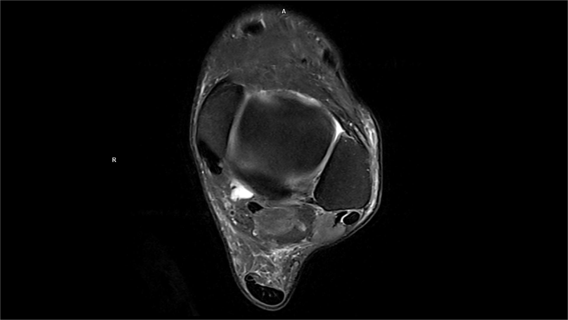 PD Axial FS DR Sharp High Lumina