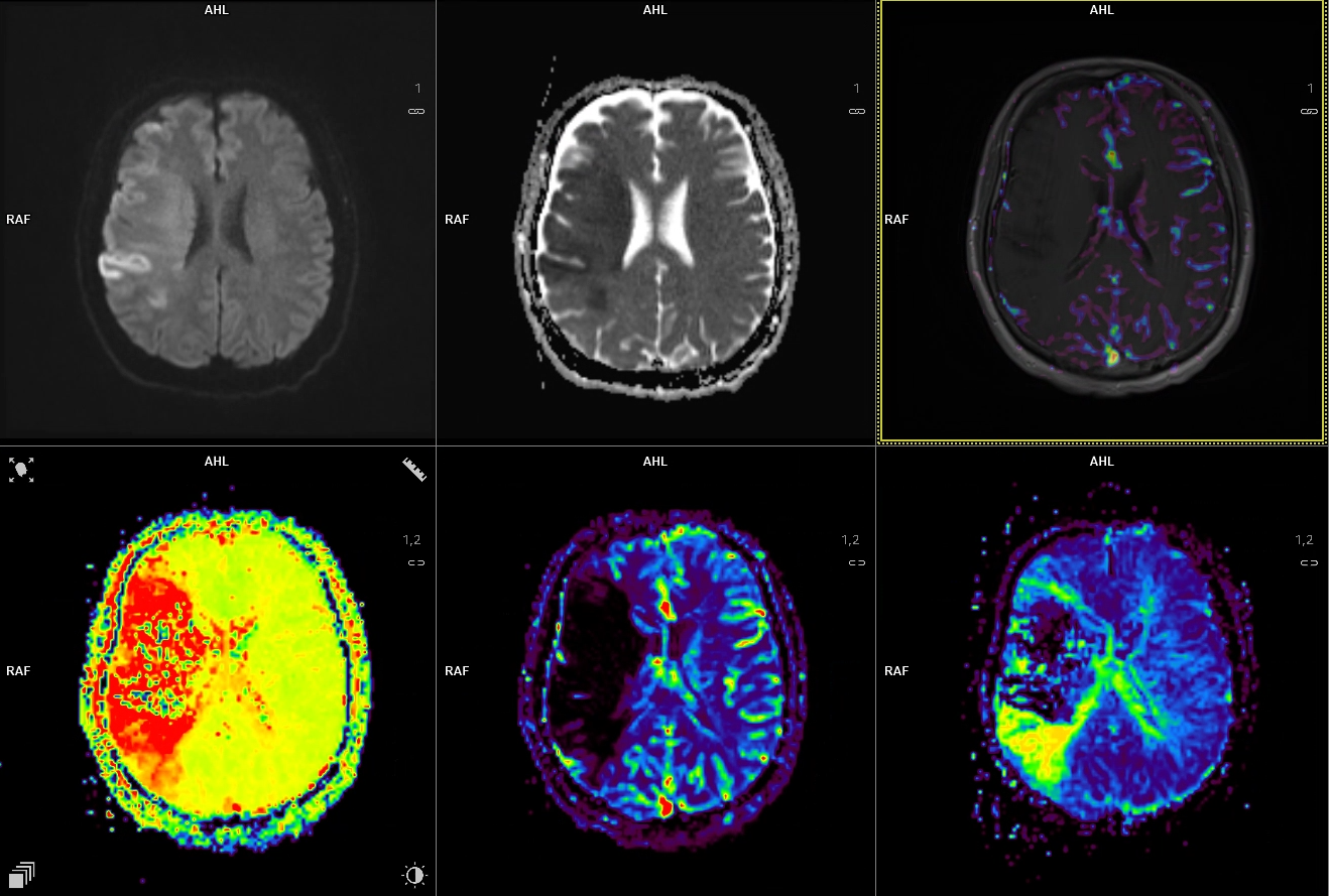 3D Post Processing - Siemens Healthineers USA