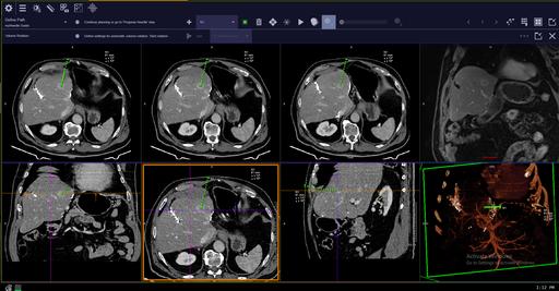 CT scanner SOMATOM go.Up eco with myExam Companion