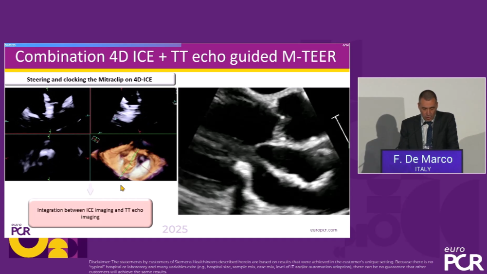 AT CVC EURO PCR 2025 revolutionising cardiac imaging