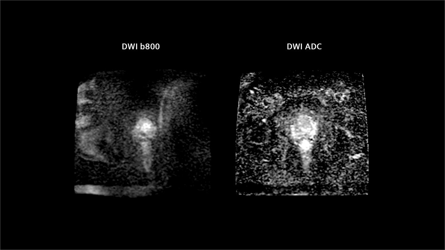 Functional imaging provides critical biological insights for RT planning