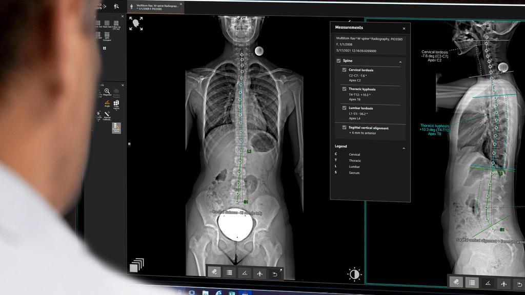 Full Body Radiography Multitom Rax With True2scale Body Scan - Siemens Healthineers