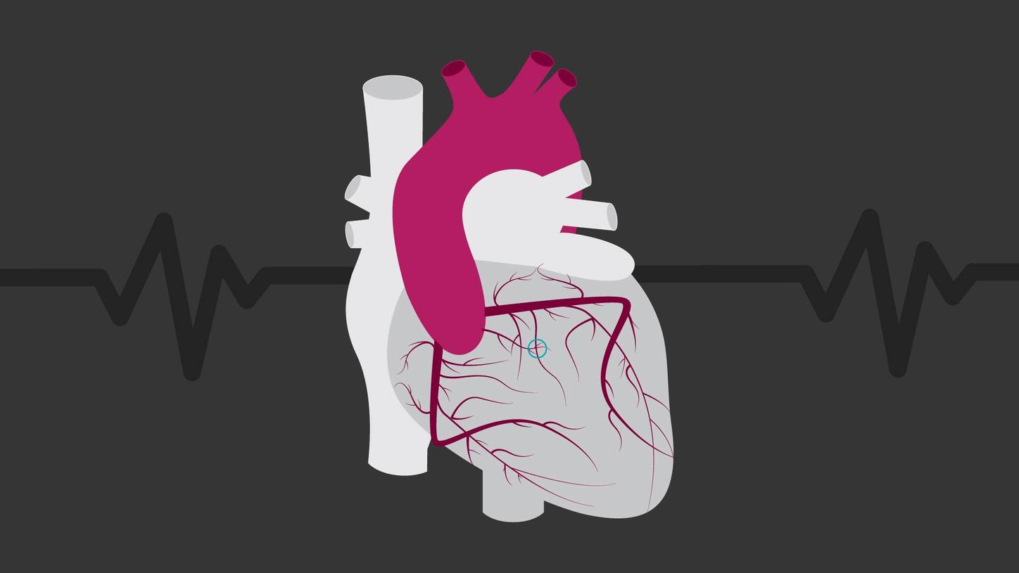 heart 3 
