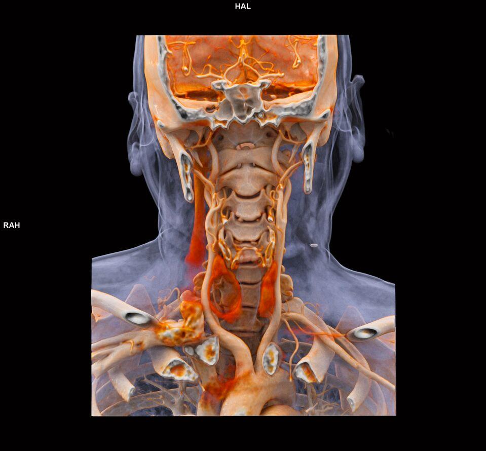 za-CT Vascular