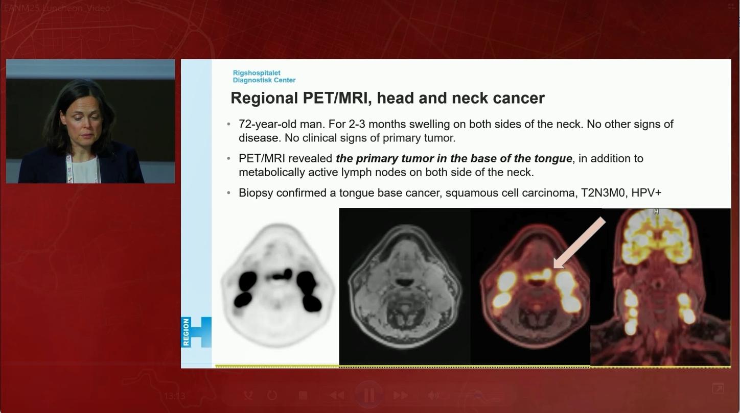 Preview Clinical Talk Adrienne Campbell-Washburn