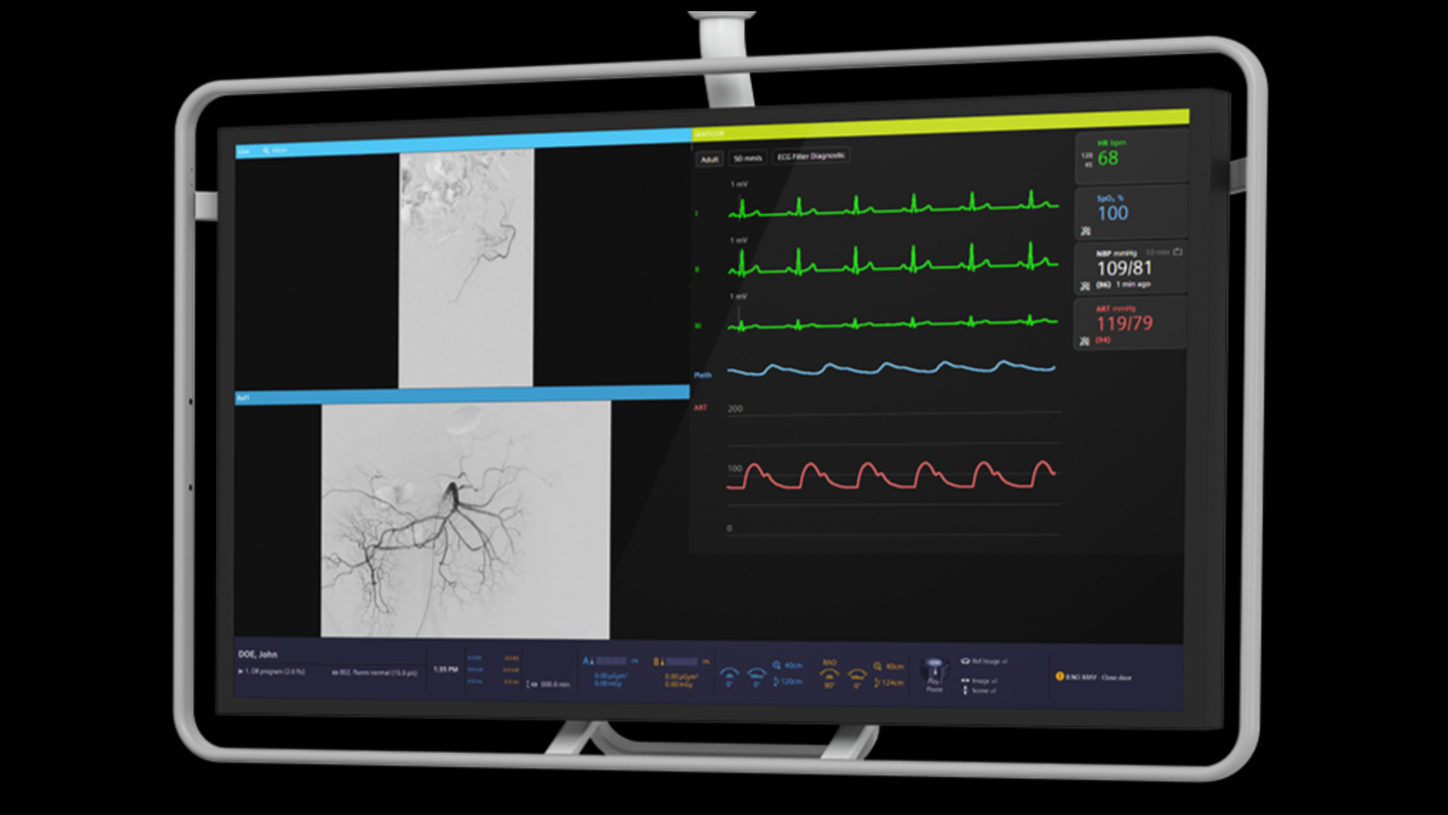 The seamless ARTIS integration enables fully embedded visualization in both the control room and the examination room.